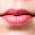 剥脱性口唇炎の原因や治療法を徹底的に解説